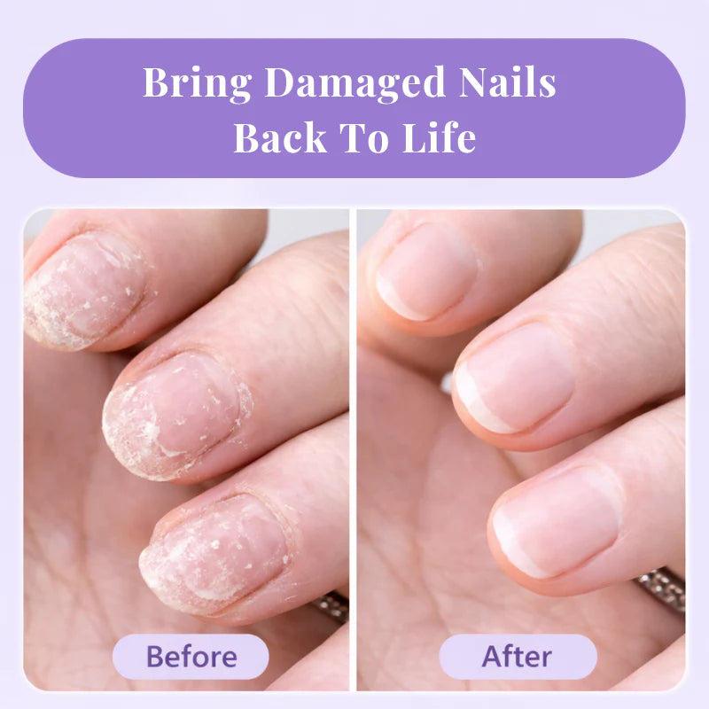 NailRenew™ Growth & Repair Pen