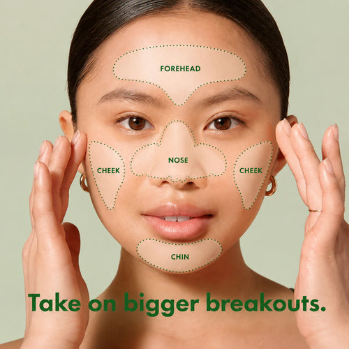AcneReset™ Full-Face Pimple Patches