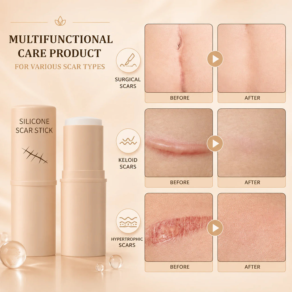 ScarEase™ Silicone Scar Fading Stick