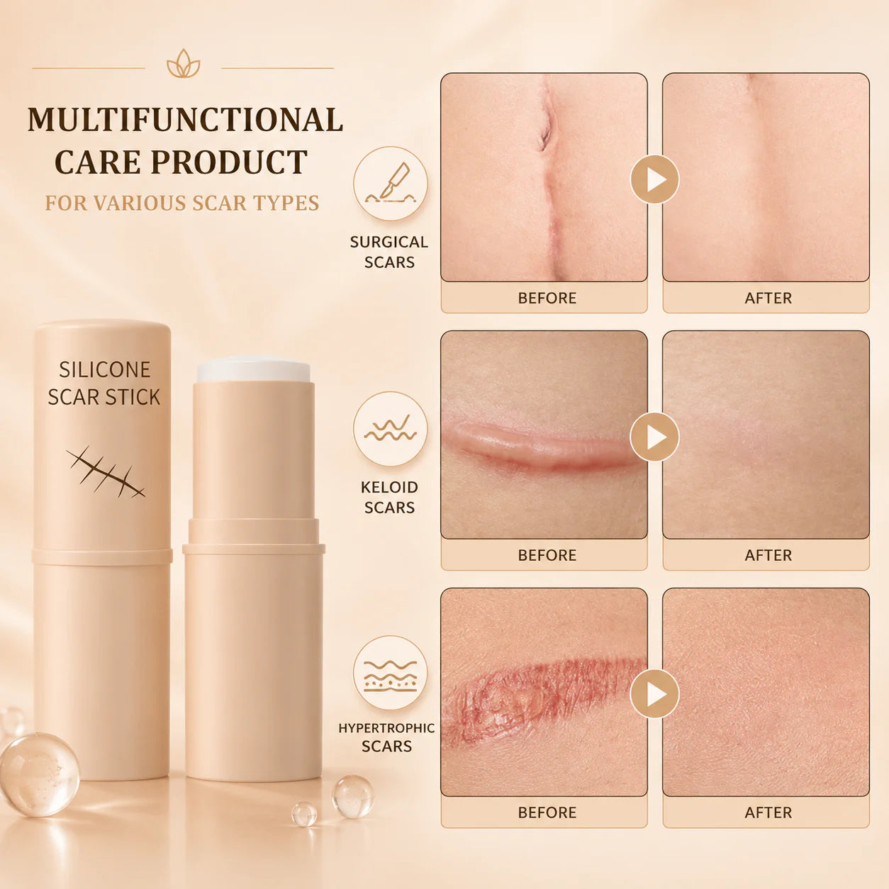 FadeStick Silicone Scar Stick