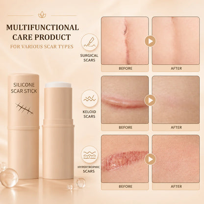 FadeStick Silicone Scar Stick