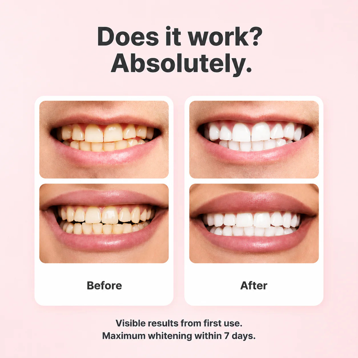Feimuko™ Smile Polish