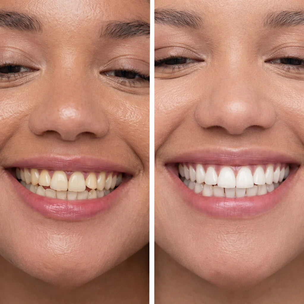Feimuko™ Smile Polish